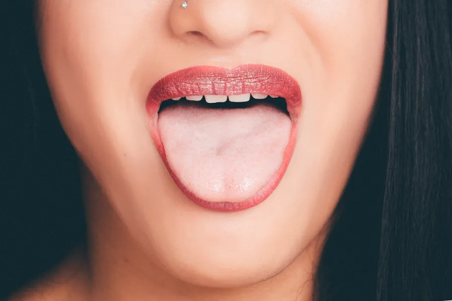 A close up of a woman's mouth showing her dry mouth and tongue