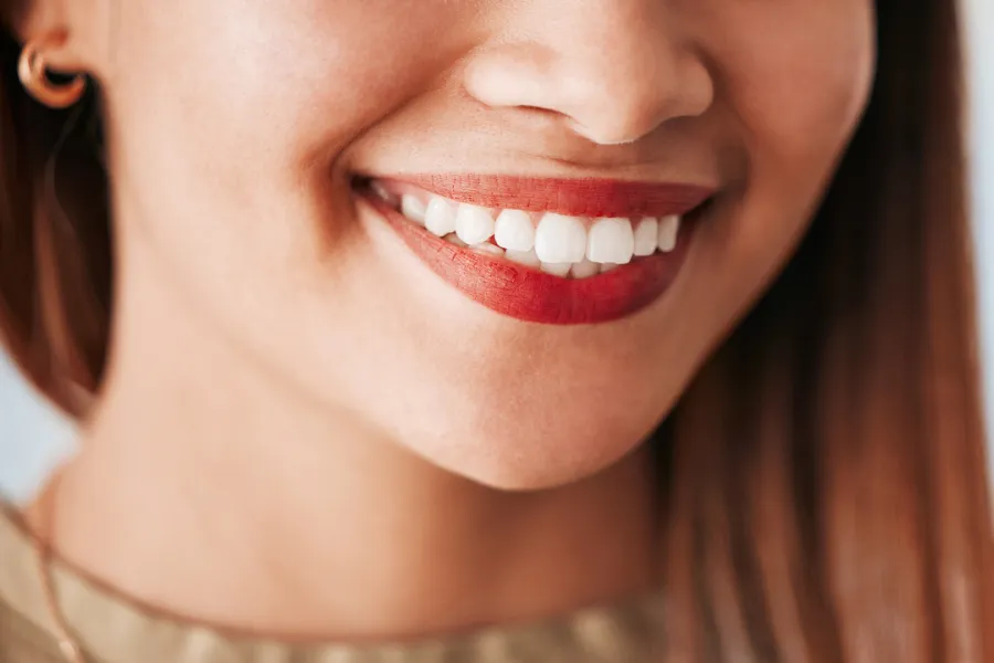 Close-up of a woman smiling and showing her bright white teeth