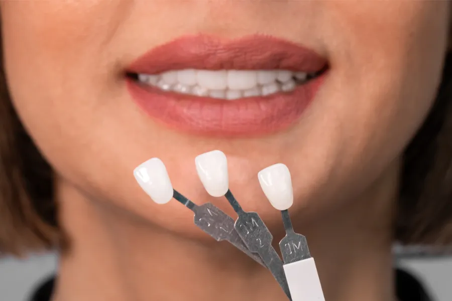 Are Veneers Right for You? Pros, Cons, and Key Considerations